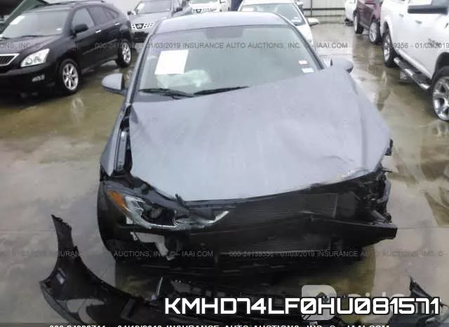 KMHD74LF0HU081571 фото 7