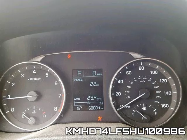KMHD74LF5HU100986 фото 9