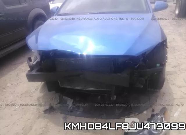 KMHD84LF8JU473099 фото 7