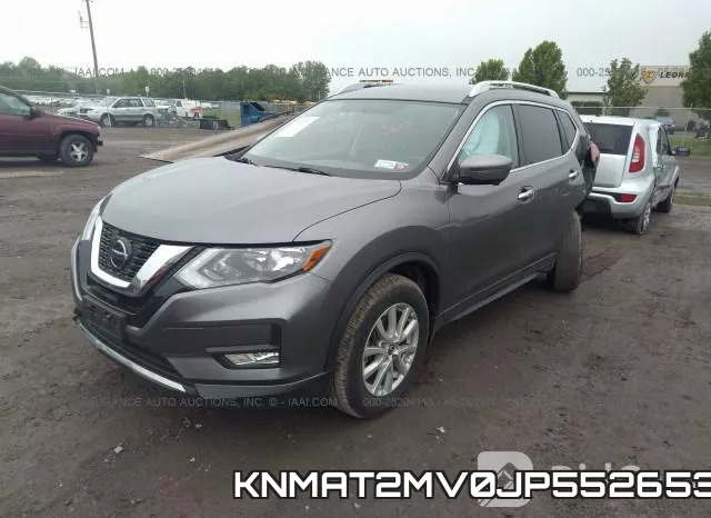 KNMAT2MV0JP552653 фото 3
