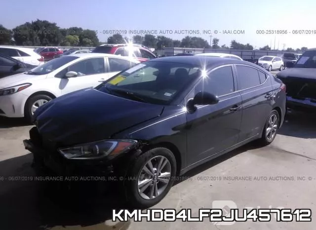 KMHD84LF2JU457612 фото 3