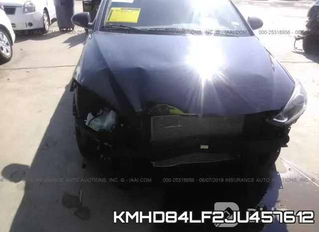 KMHD84LF2JU457612 фото 7