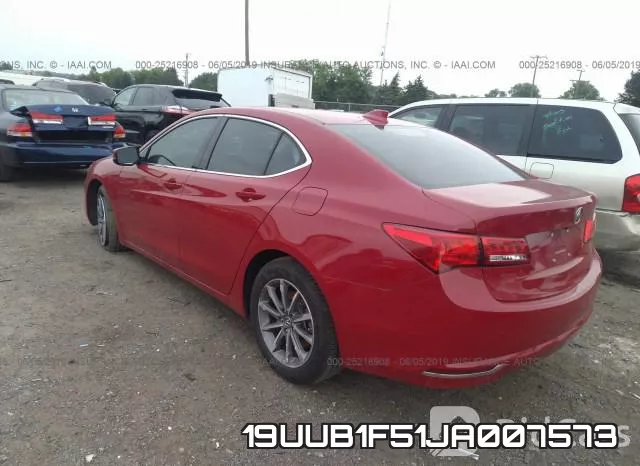 19UUB1F51JA007573 фото 4