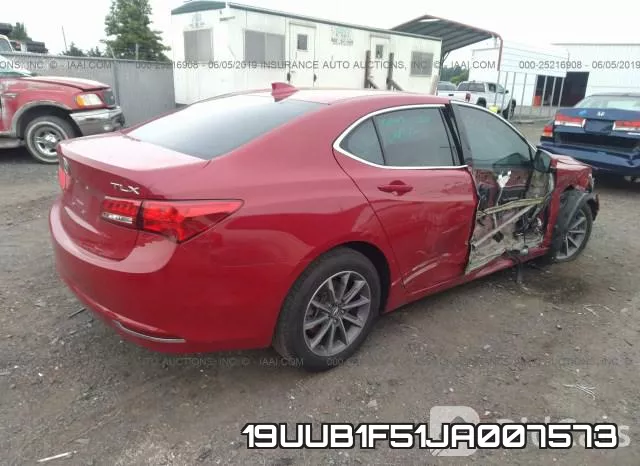 19UUB1F51JA007573 фото 5