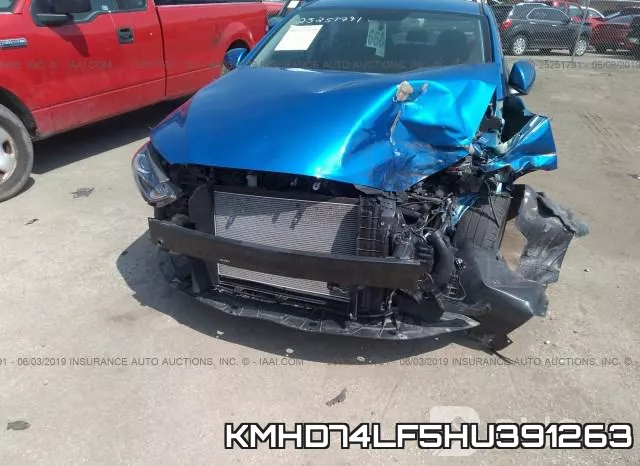 KMHD74LF5HU391263 фото 7