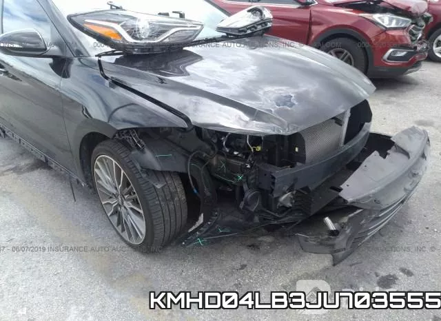 KMHD04LB3JU703555 фото 7