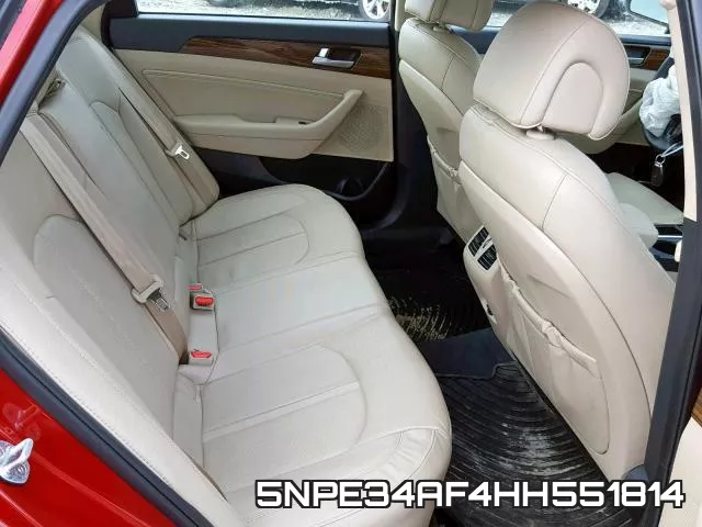 5NPE34AF4HH551814 фото 7