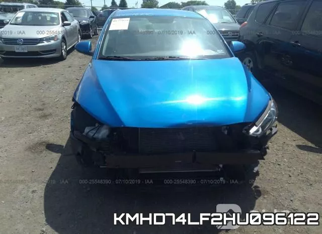 KMHD74LF2HU096122 фото 7