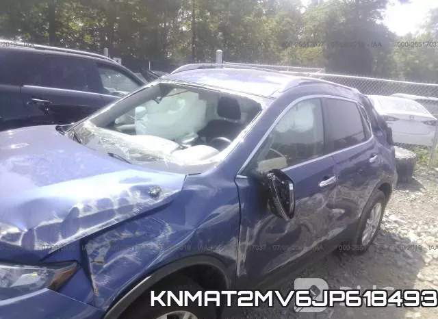 KNMAT2MV6JP618493 фото 7
