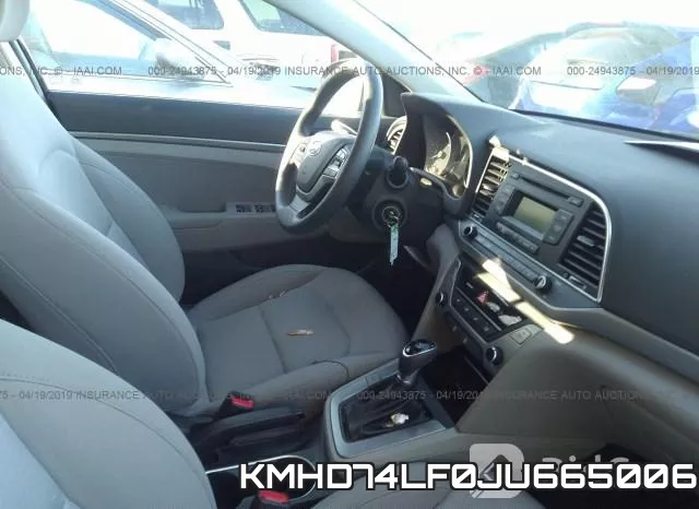 KMHD74LF0JU665006 фото 6