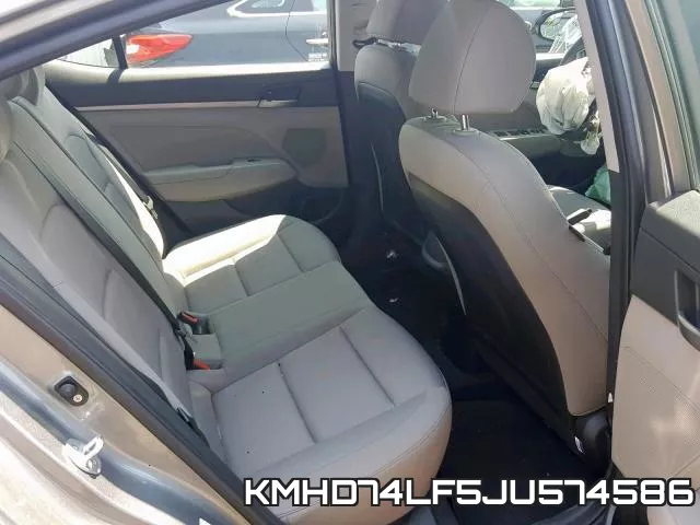 KMHD74LF5JU574586 фото 7