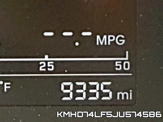 KMHD74LF5JU574586 фото 9