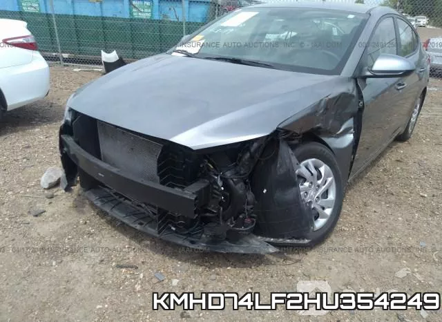 KMHD74LF2HU354249 фото 7
