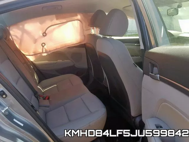 KMHD84LF5JU599842 фото 7