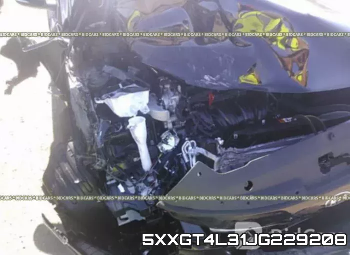 5XXGT4L31JG229208 фото 7