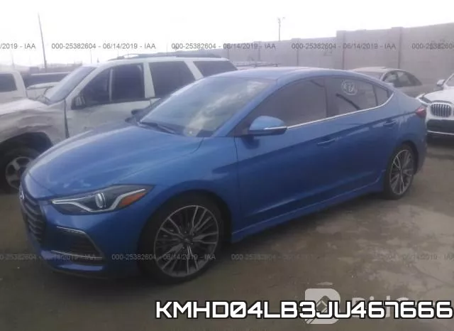 KMHD04LB3JU467666 фото 3