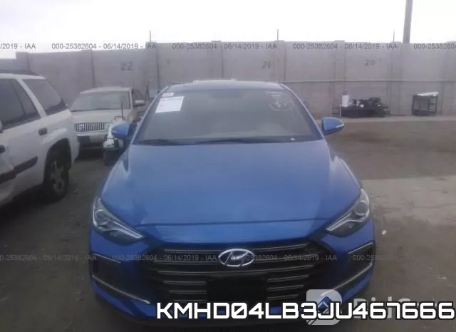 KMHD04LB3JU467666 фото 7