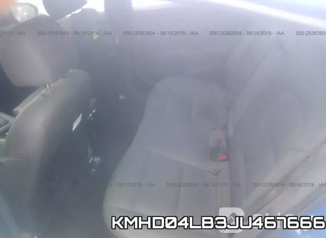 KMHD04LB3JU467666 фото 9
