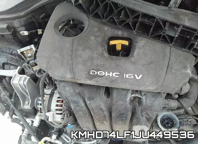 KMHD74LF1JU449536 фото 2