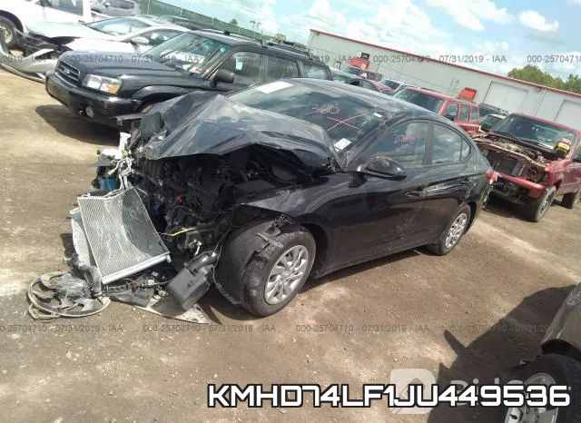 KMHD74LF1JU449536 фото 3
