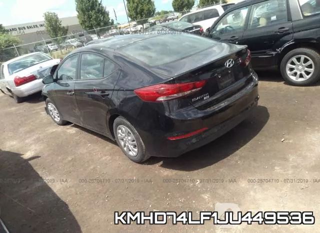 KMHD74LF1JU449536 фото 4