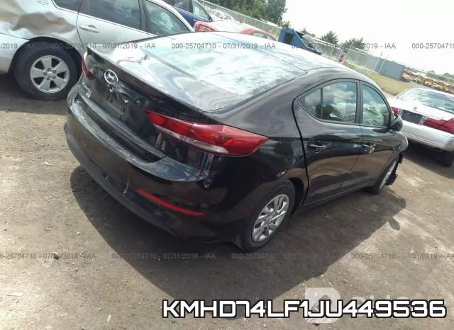 KMHD74LF1JU449536 фото 5