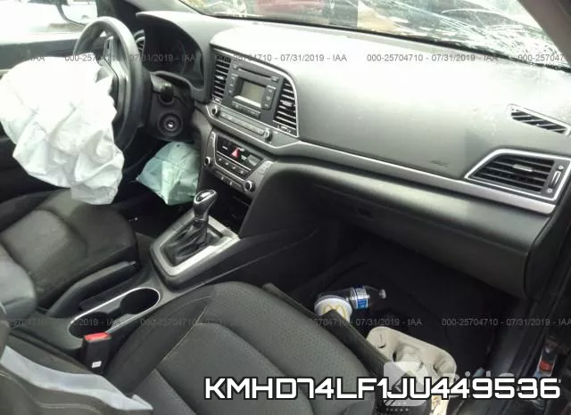 KMHD74LF1JU449536 фото 6