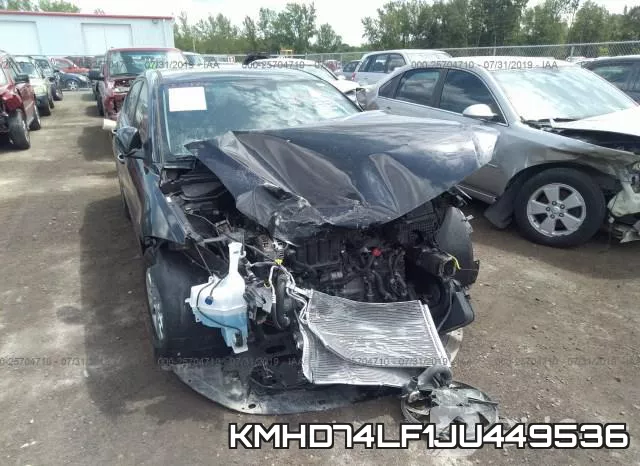 KMHD74LF1JU449536 фото 7