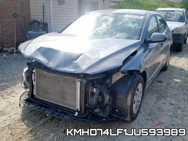 KMHD74LF1JU593989 фото 3