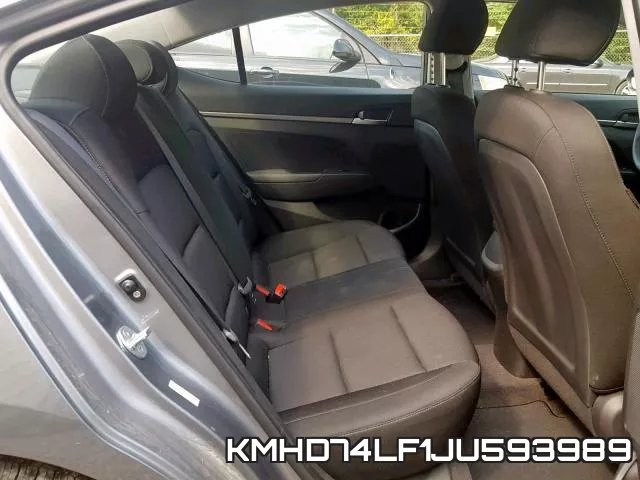 KMHD74LF1JU593989 фото 7