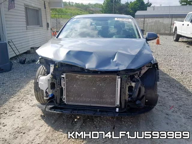 KMHD74LF1JU593989 фото 10