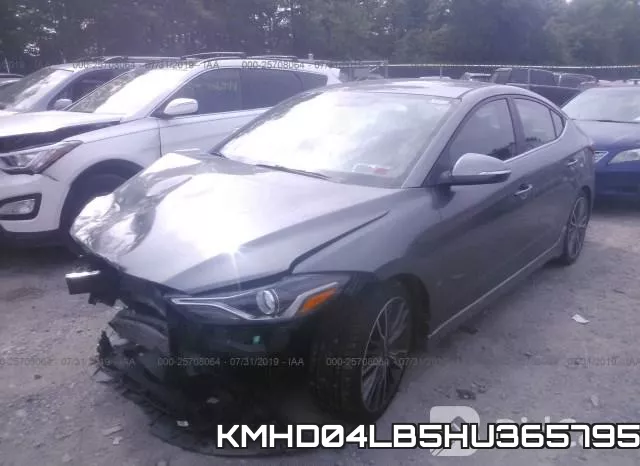 KMHD04LB5HU365795 фото 3