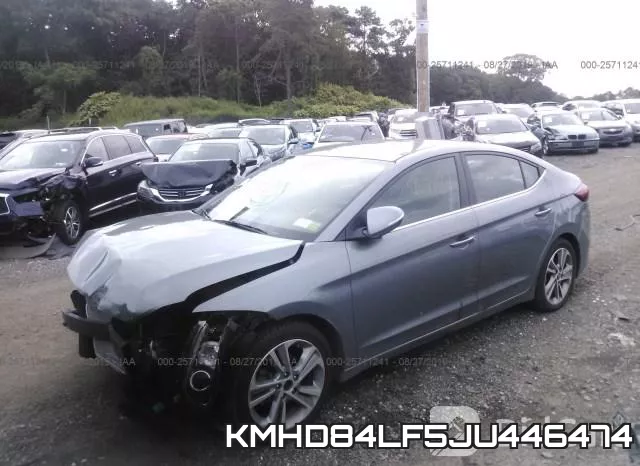 KMHD84LF5JU446474 фото 3