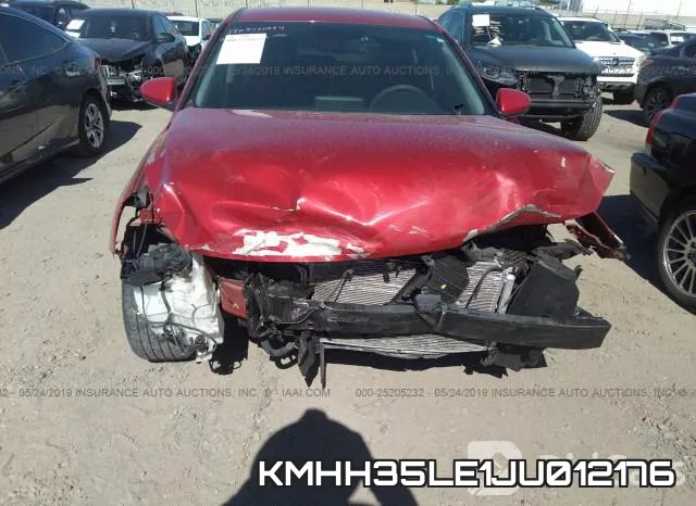 KMHH35LE1JU012176 фото 7