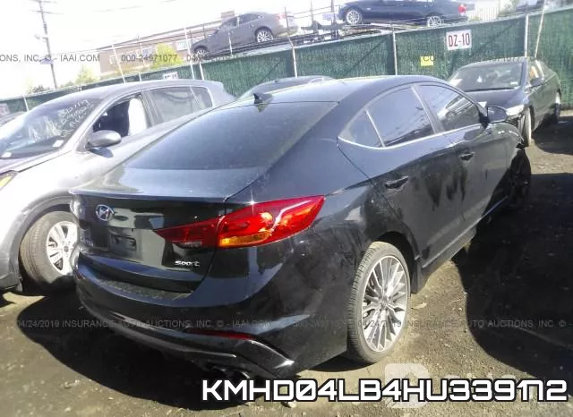 KMHD04LB4HU339172 фото 5