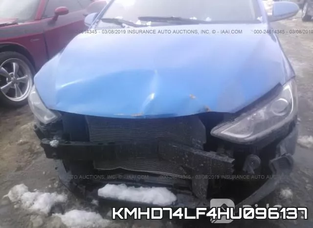 KMHD74LF4HU096137 фото 7