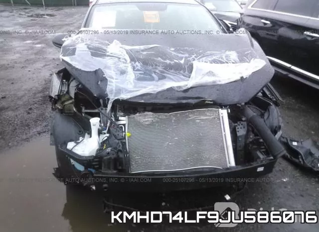 KMHD74LF9JU586076 фото 7