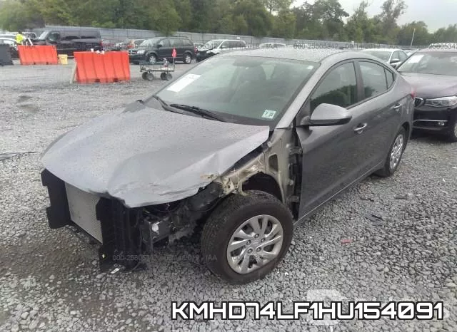 KMHD74LF1HU154091 фото 3