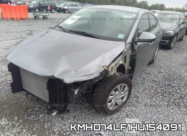 KMHD74LF1HU154091 фото 7