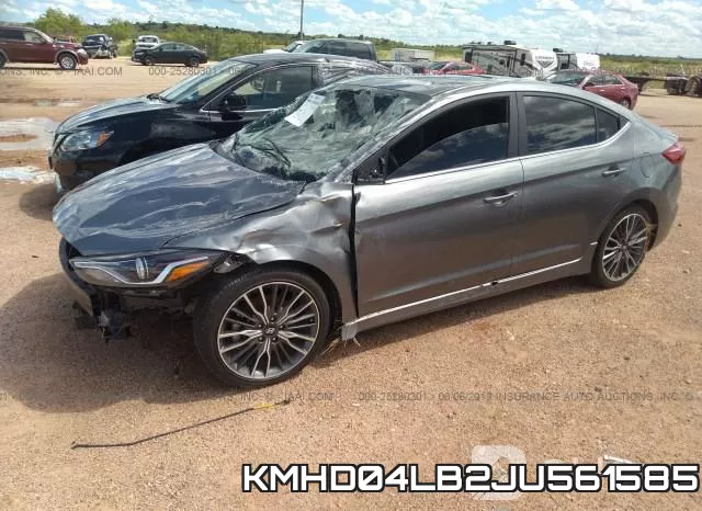 KMHD04LB2JU561585 фото 3