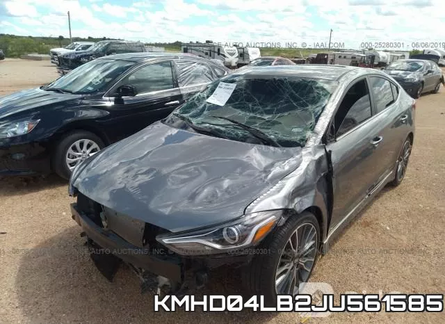 KMHD04LB2JU561585 фото 7