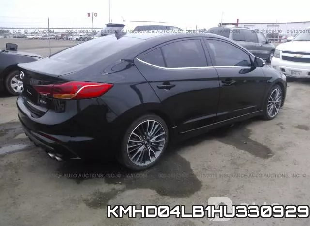 KMHD04LB1HU330929 фото 5