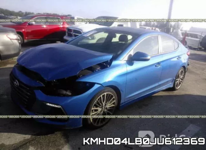 KMHD04LB0JU612369 фото 3