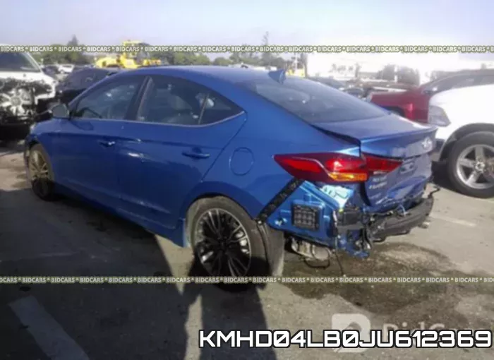 KMHD04LB0JU612369 фото 4