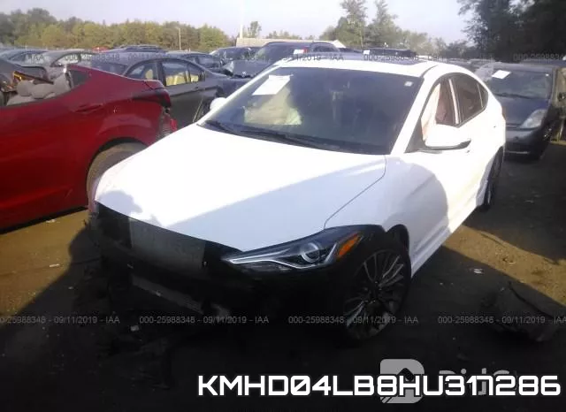 KMHD04LB8HU317286 фото 3