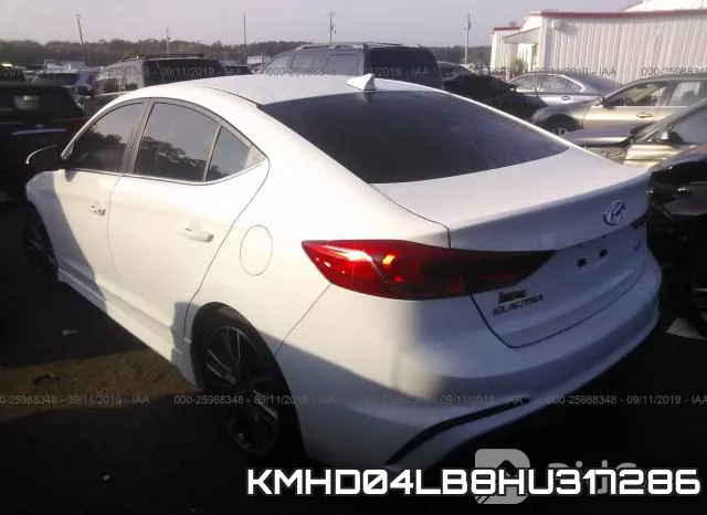KMHD04LB8HU317286 фото 4