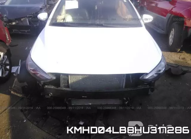 KMHD04LB8HU317286 фото 7