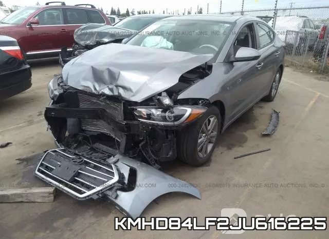 KMHD84LF2JU616225 фото 2