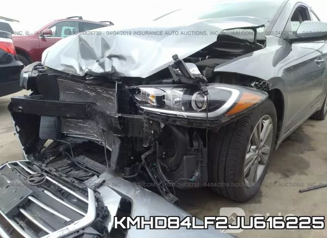 KMHD84LF2JU616225 фото 5