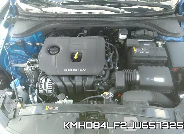 KMHD84LF2JU657325 фото 2